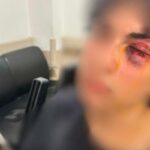 CHP standında çirkin saldırı! Standın başında şarkıya eşlik eden 15 yaşındaki çocuk darbedildi