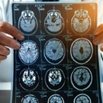 Harvard’dan çarpıcı yeni araştırma: Alzheimer tedavisine karşı yeni umut! Uzmanlar: “Bu büyük bir dönüm noktası olabilir”